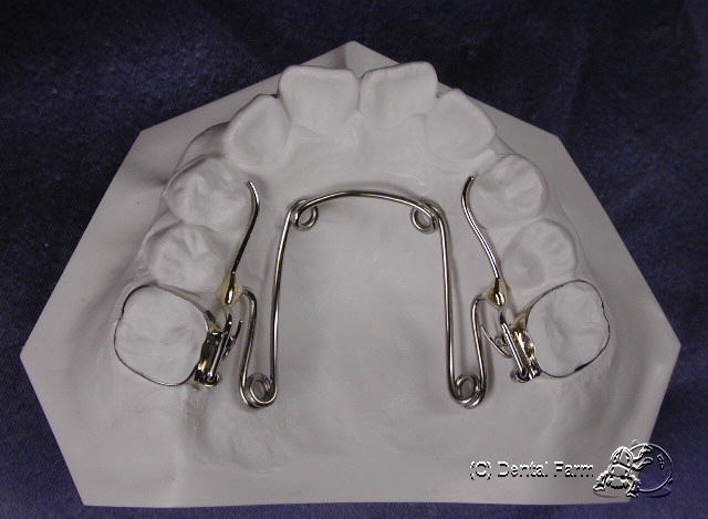 WA-1 Quad Helix+ST Lock