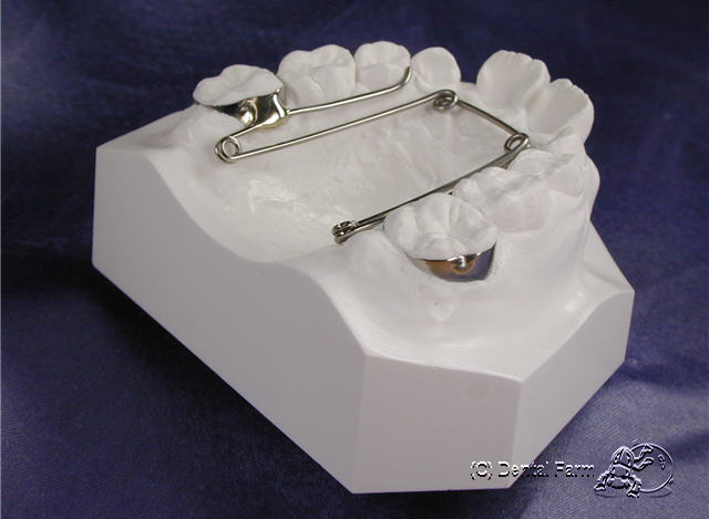 WA-1 Quad Helix